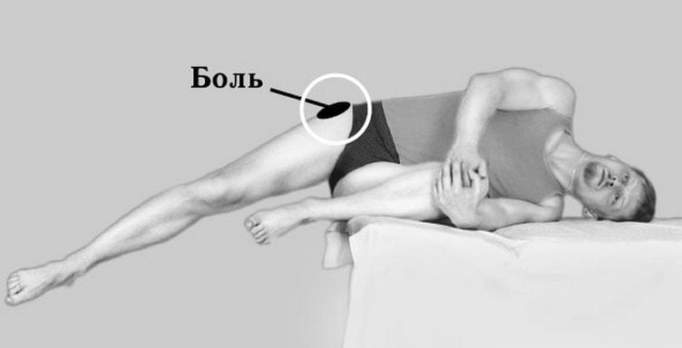 Боль в тазобедренном суставе